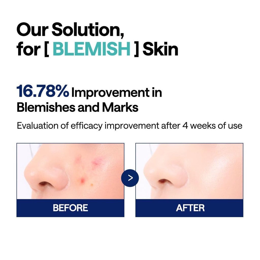 Mediheal Madecassoside Toner Pads - with Centella Asiatica to Treat Blemishes and Improve Uneven Skin Tone - Vegan Gauze Fabric