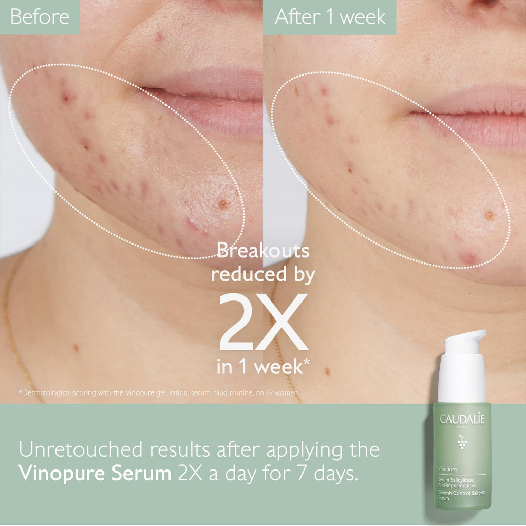 Caudalie Vinopure Natural Salicylic Acid Pore Minimizing Serum, 1 Fl Oz