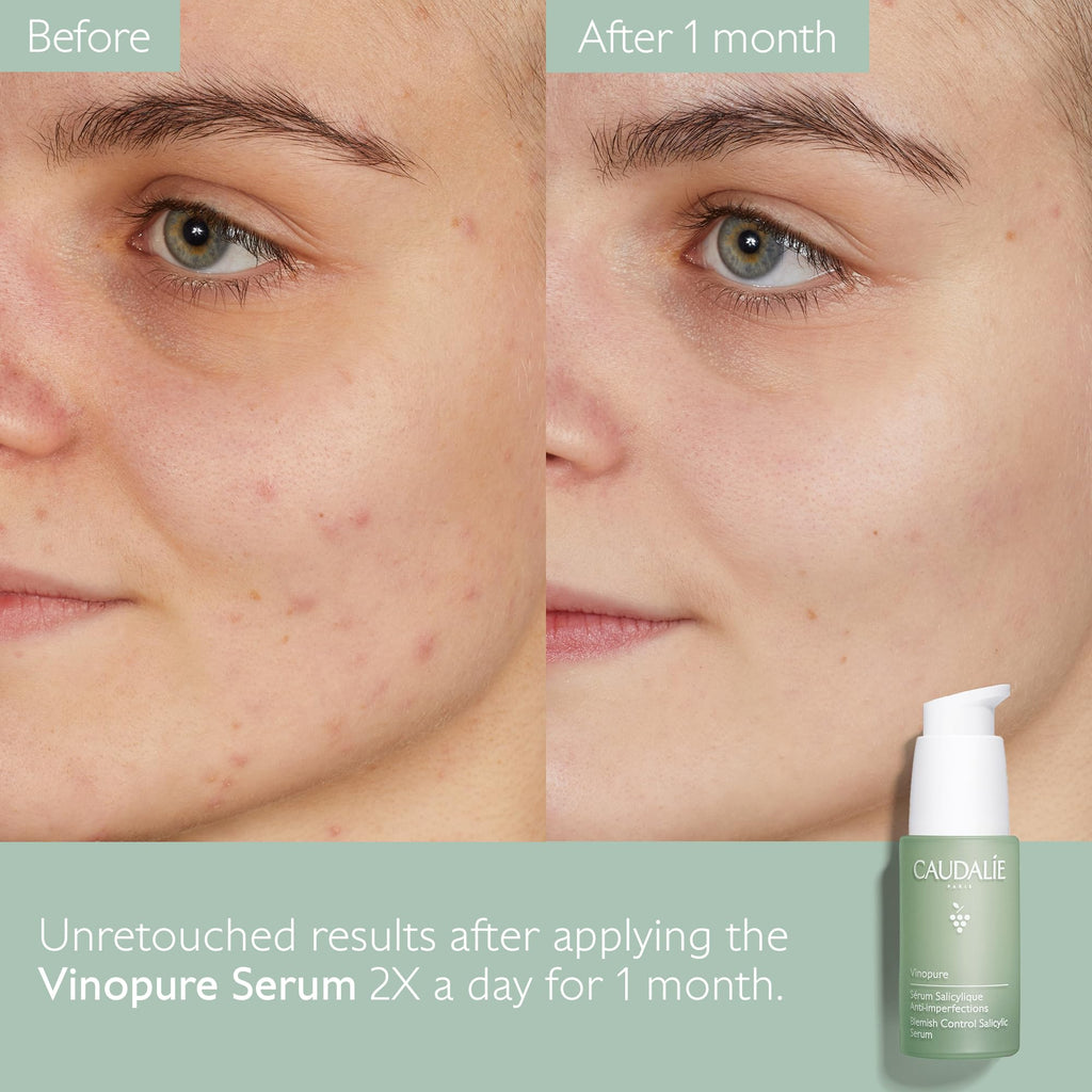 Caudalie Vinopure Natural Salicylic Acid Pore Minimizing Serum, 1 Fl Oz