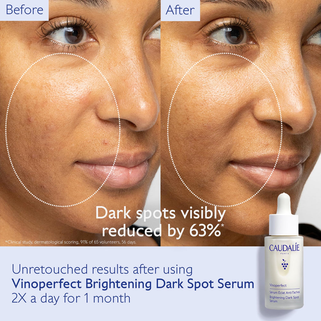 Caudalie Dark Spot Brightening Skin Care Set - Vinoperfect Brightening Dark Spot Serum Full Size + 2 Free Travel-Size Products ($120 Value)
