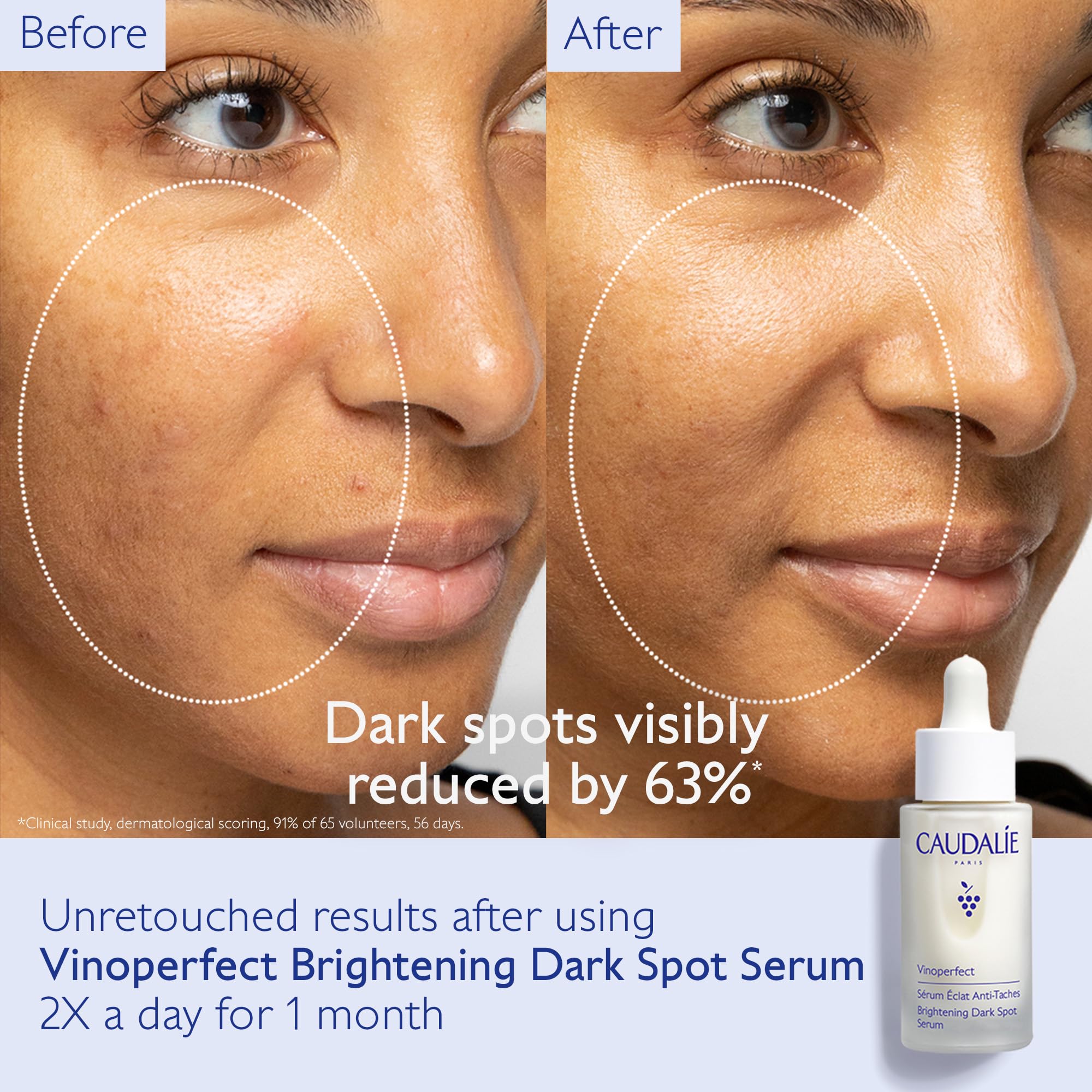 Caudalie Dark Spot Brightening Skin Care Set - Vinoperfect Brightening Dark Spot Serum Full Size + 2 Free Travel-Size Products ($120 Value)