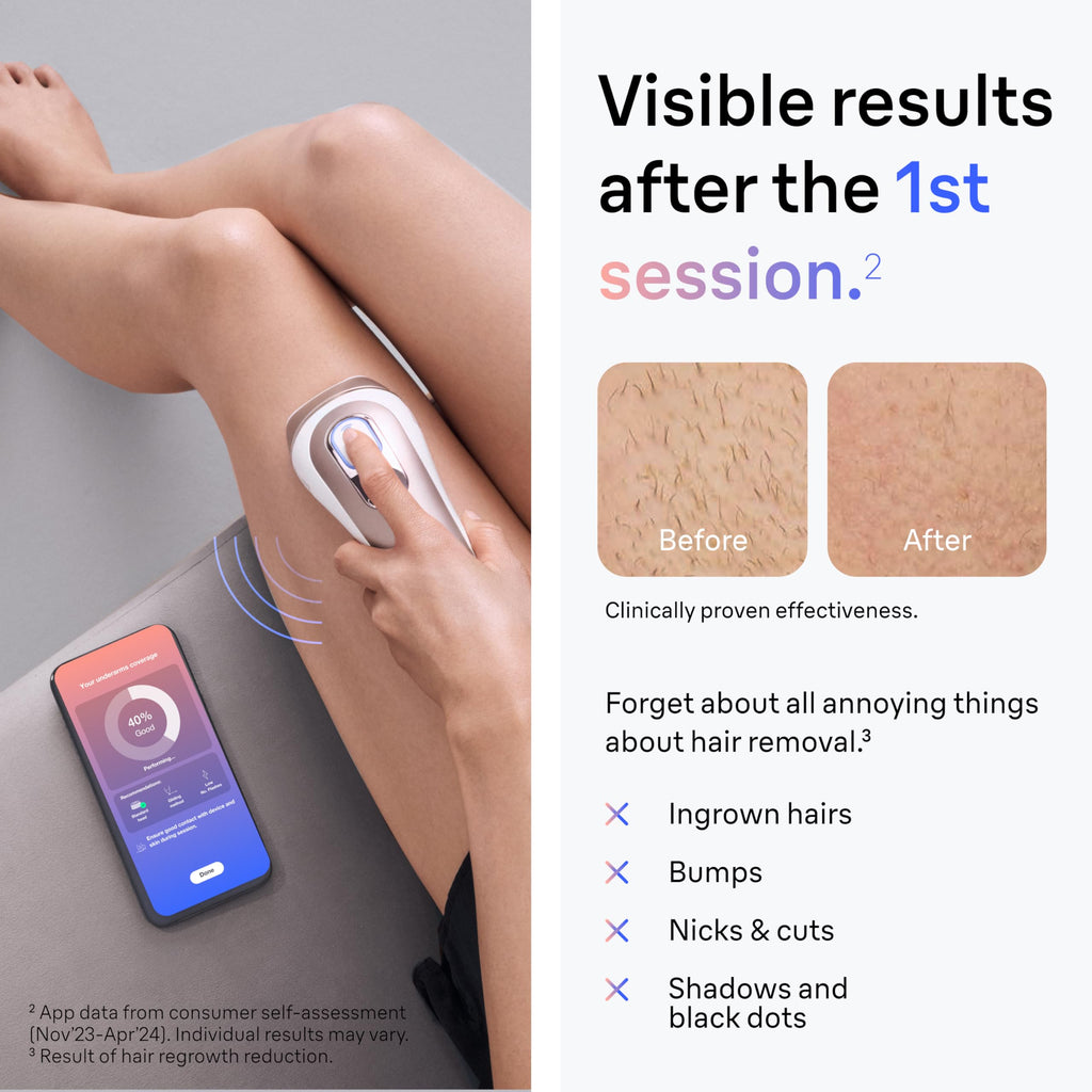 Braun IPL Skin i·Expert, at Home Laser Hair Removal, Holiday Gifts for Women and Men with Free App, Smart IPL, Vanity Case, Venus Razor, 2 Smart Heads, Facial Trimmer, PL7219